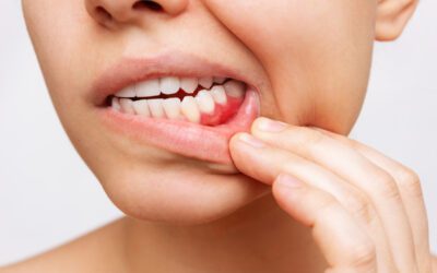 ¿Por qué se inflaman las encías? Causas, síntomas y soluciones efectivas